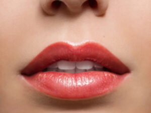 Dra. Gisele Araujo boca